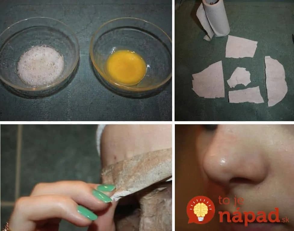 Fotopostup: Najlepšia domáca pleťová maska z 1 vajíčka!