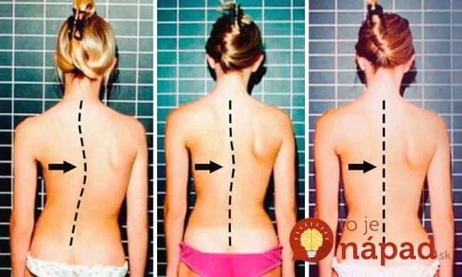 Bolí vás chrbtica? Týchto 6 jednoduchých cvikov dokáže zázraky!