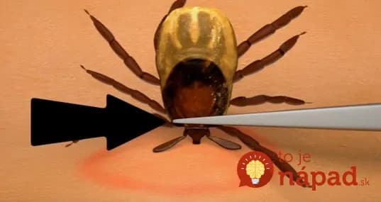 Video: Viete ako správne odstrániť kliešťa: Toto je najlepší spôsob!