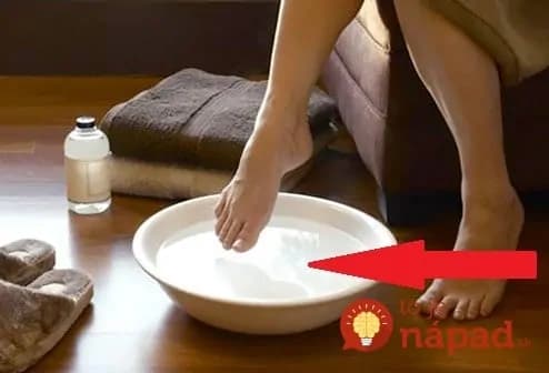 Pleseň na chodidlách? Tento domáci recept pomôže už o 20 minút!