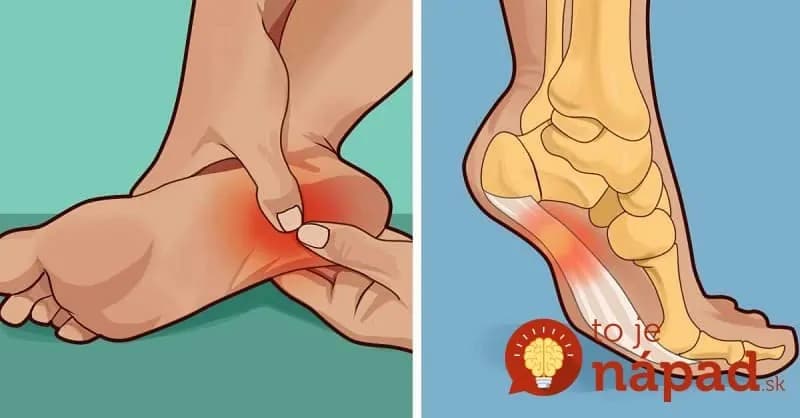 Prekvapil vás kŕč v chodidle? Zbavte sa ho za sekundu pomocou jednoduchého triku!