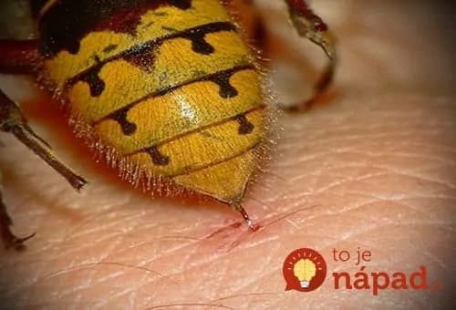 Už žiadne štípance! Takto si udržíte osy od tela celé leto