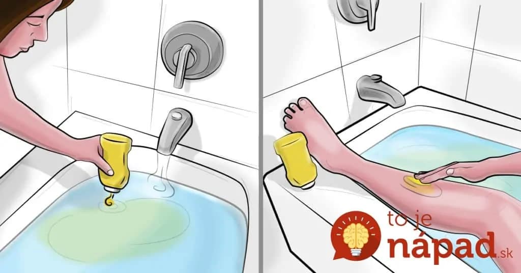 Trápi vás zapálené hrdlo, popáleniny či bolesť svalov? Pomôže prekvapivá surovina, ktorú máte doma!