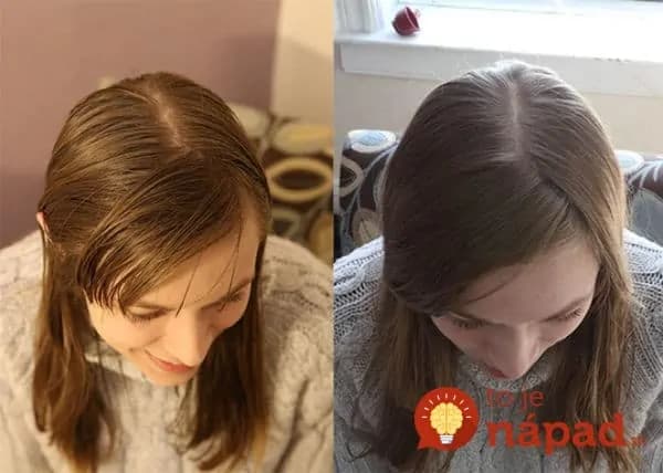 Žena si prestala umývať vlasy šampónom a nahradila ho niečím, čo má doma každý. Výsledky sú ohromné