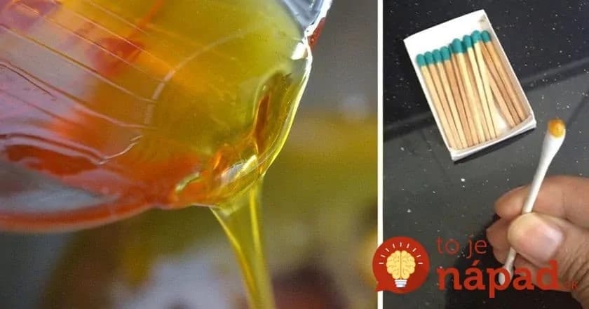 Rozpoznáte pravý med od falošného? Vďaka tomuto jednoduchému testu nikdy nenaletíte!