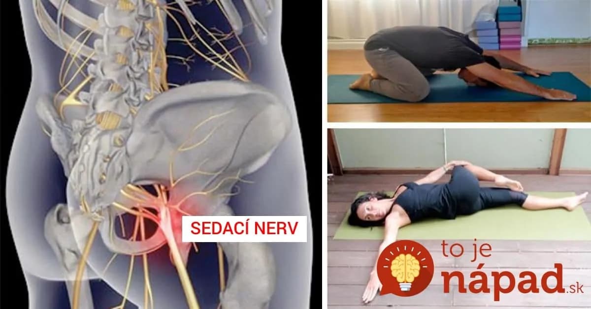 Zápal sedacieho nervu môžete poraziť aj doma! 8 jednoduchých cvikov, ktoré fungujú zázračne