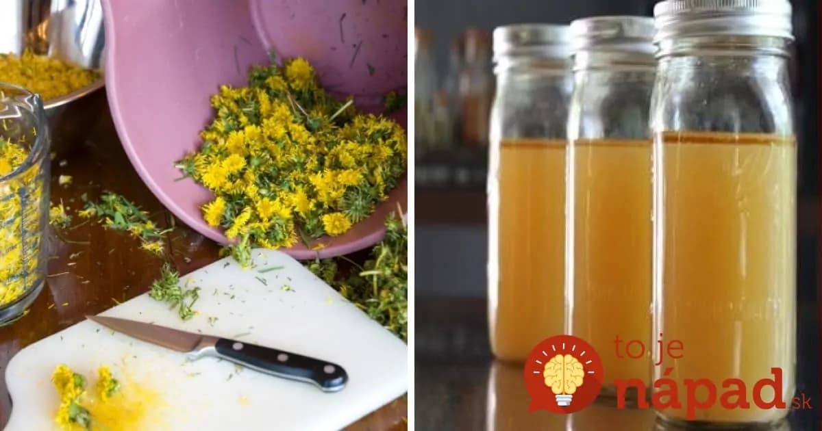 Púpavový olej je záchranou pre vaše kĺby: Nepremeškajte príležitosť a vyrobte si ho, vydrží celý rok!