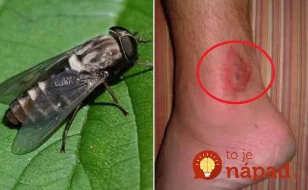 Muž prišiel s geniálnym nápadom, ako sa zbaviť ovadov: Vymyslel jednoduchú pascu do ktorej sa chytilo 1697 ovadov za jediný týždeň!