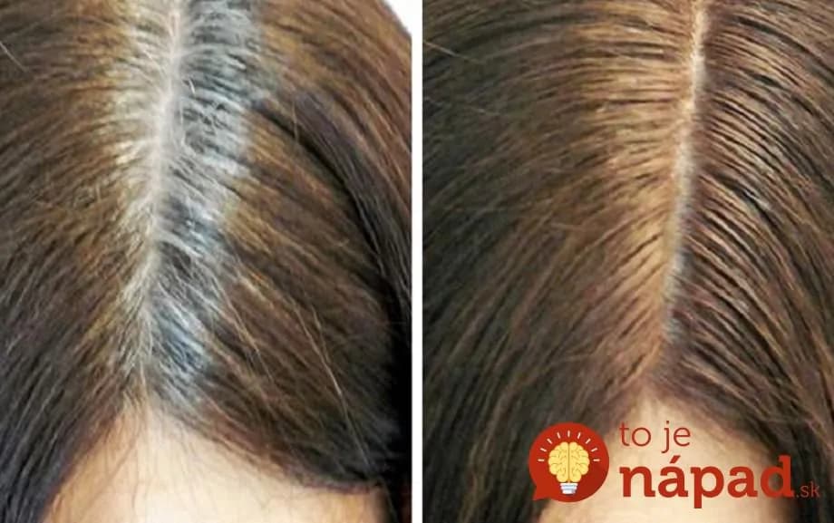 Trápia vás šediny? Naše babičky miesto chemických farieb používali prekvapivo jednoduchý recept