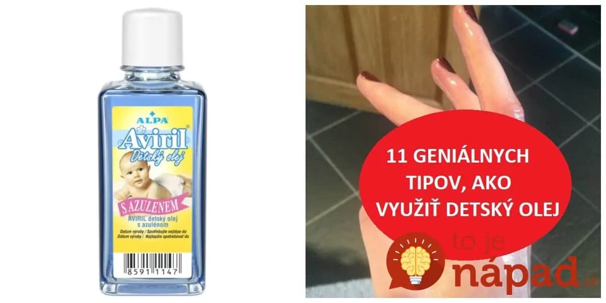 Ako deti sme ho poznali všetci: Toto je dôvod, prečo by ste detský olej nemali pustiť z ruky ani dnes!