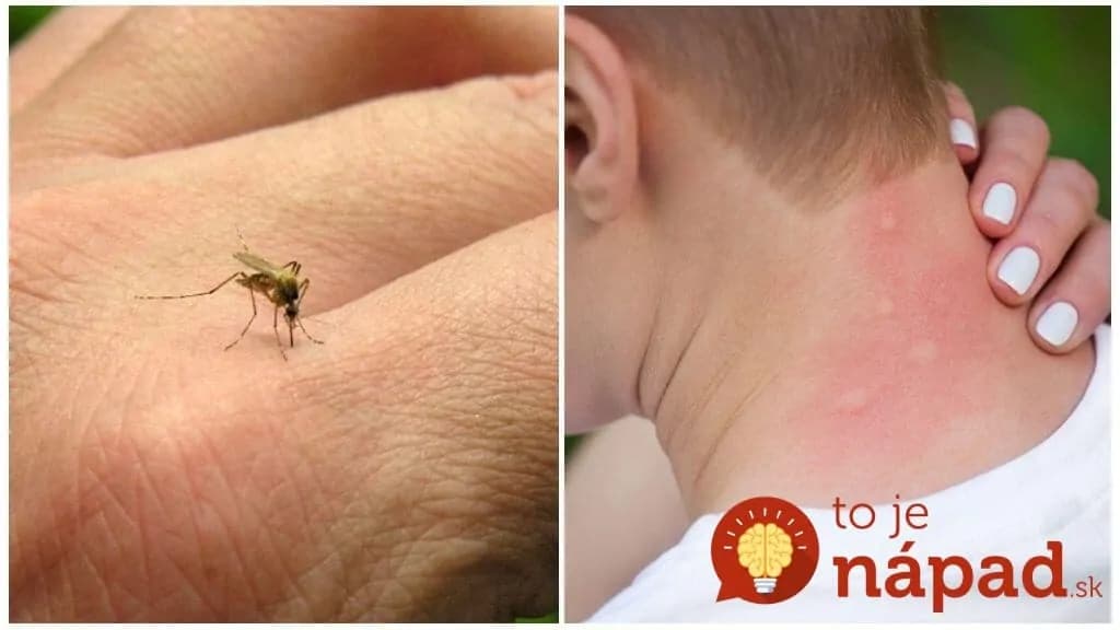 Rada nad zlato pre každého, koho idú v lete „zožrať“ komáre: Nedotknú sa nikoho, kto si dá do okien toto!