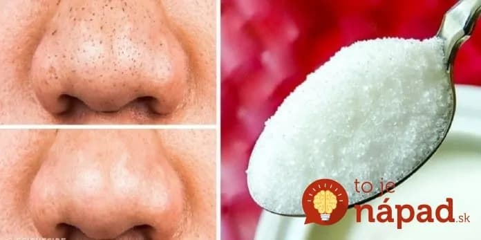 Kozmetička poradila, ako používať obyčajný cukor spôsobom, o akom sa nám nesnívalo: Tvár skrásnie aj v 60-tke!