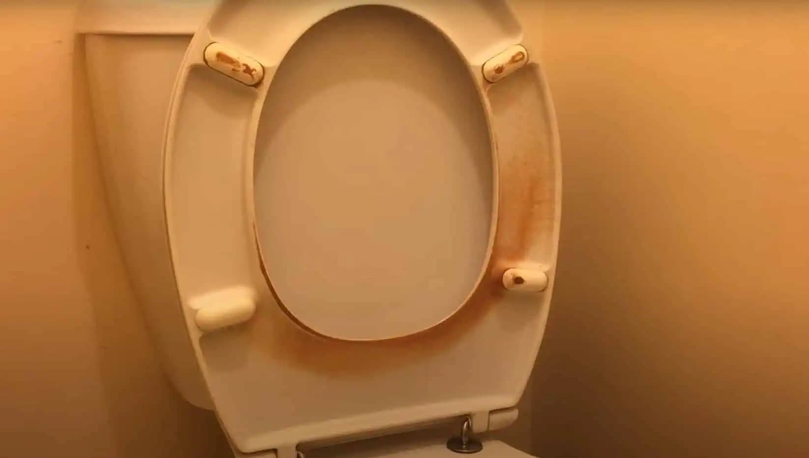 Zbavte sa žltých škvŕn na záchodovej doske: Vďaka tomuto triku bude opäť biela, ako nová!