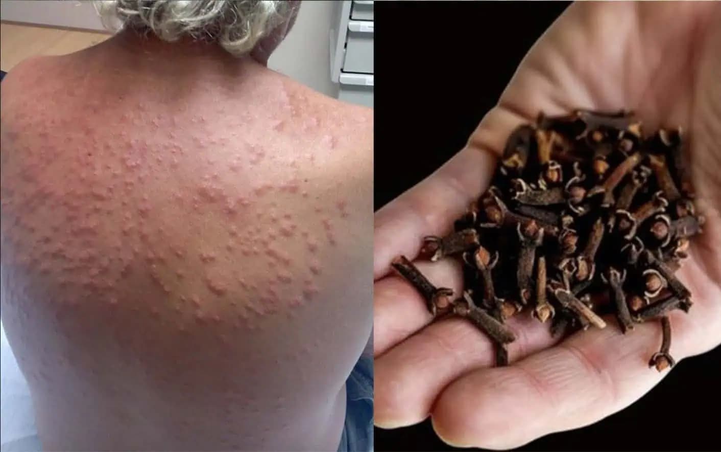 Toto leto bude bez KOMÁROV: Najviac nenávidia obyčajné klinčeky!