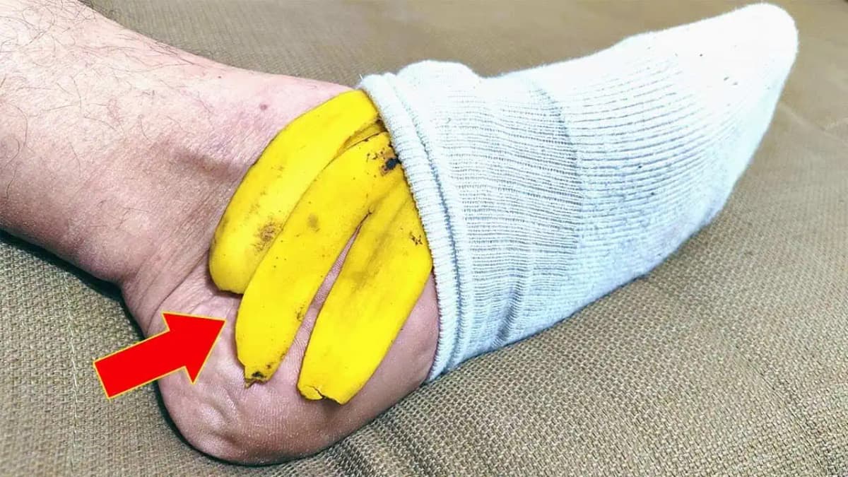 NIKDY nevyhadzuje banánovú šupku: Toto dokáže, ak si ju priložíte na nohu!