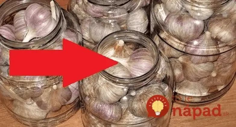 Najlepšia rada, ako uchovať cesnak na celý rok: Šťavnatý, voňavý a presne ako čerstvý + tip, ako skladovať kupovaný cesnak a cibuľu!