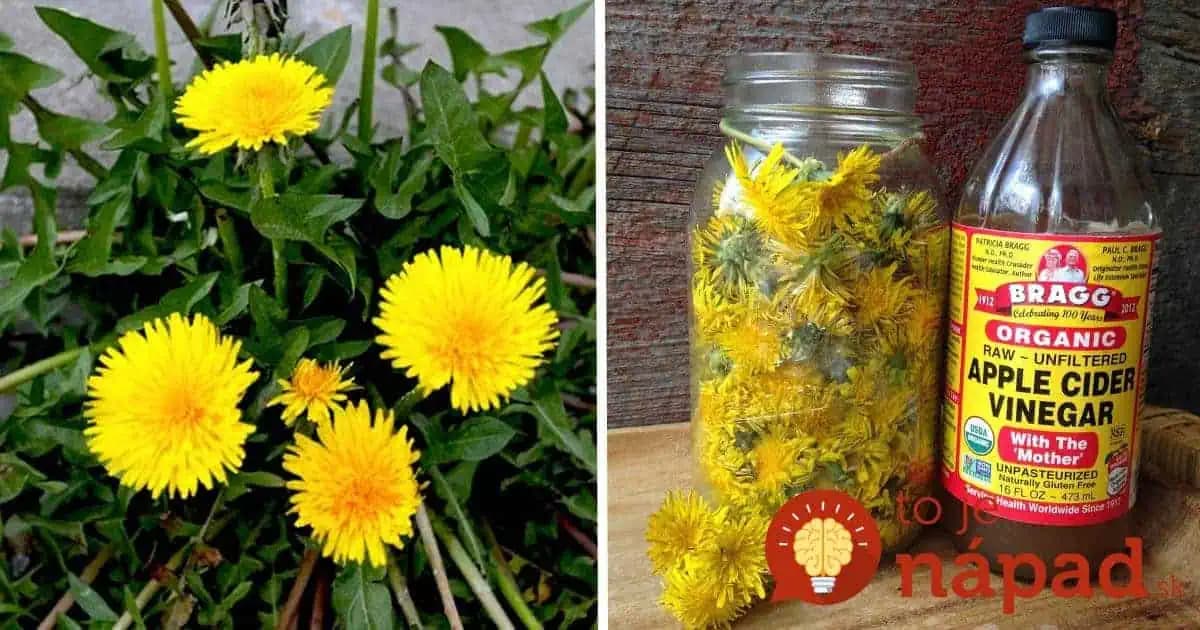 Tri hrste púpavových hlavičiek zalejte octom a nechajte odstáť: To, čo po dvoch týždňoch vznikne, vyvážite v domácnosti zlatom!