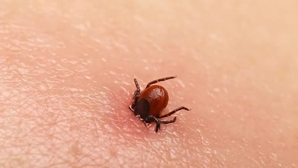 Toto povedzte každému, na koho každý rok lezú KLIEŠTE: Overené, odskúšané – len toto na ne funguje!
