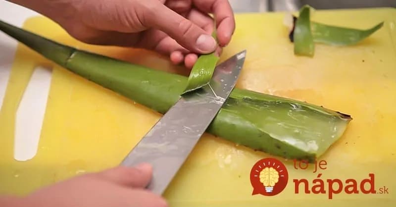Máte doma aloe vera? Takto jednoducho z neho vyrobíte liečivý gél!