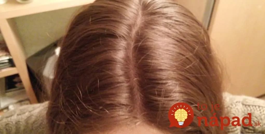 Nestihli ste si umyť vlasy? S týmto trikom budú o pár sekúnd ako čerstvo umyté a to nie je všetko!