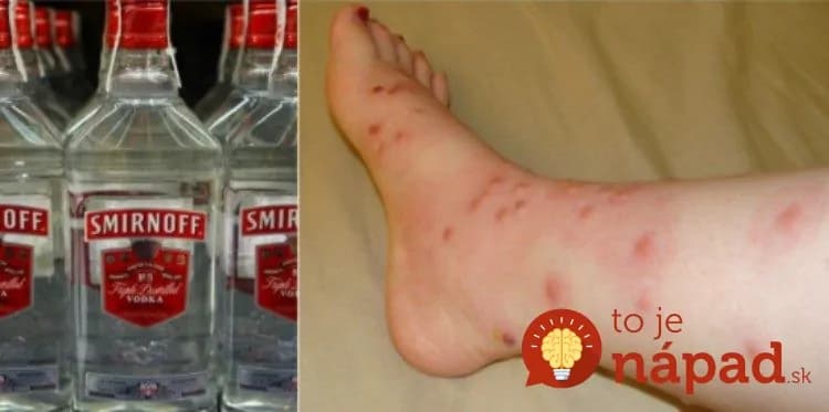 Viete, že vodku môžete piť: Tušili ste však, že dokáže vyriešiť 9 problémov, s ktorými sa denne stretávate?