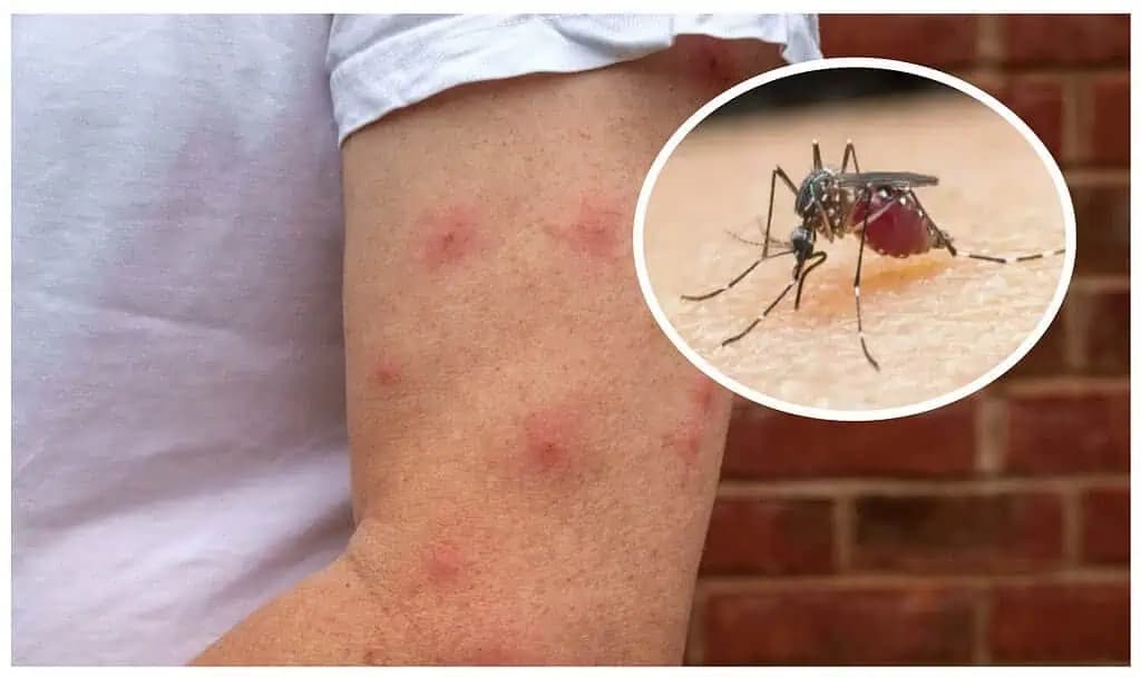 Jednoduché a lacné riešenie, ako sa zbaviť KOMÁROV vonku aj vnútri: Koniec bzučania a štípancom!